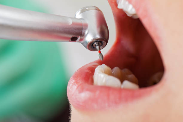 Best Dentist for Tooth Abscess  in Hemlock Farms, PA